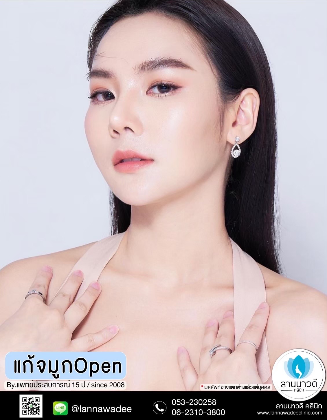 แก้จมูก open