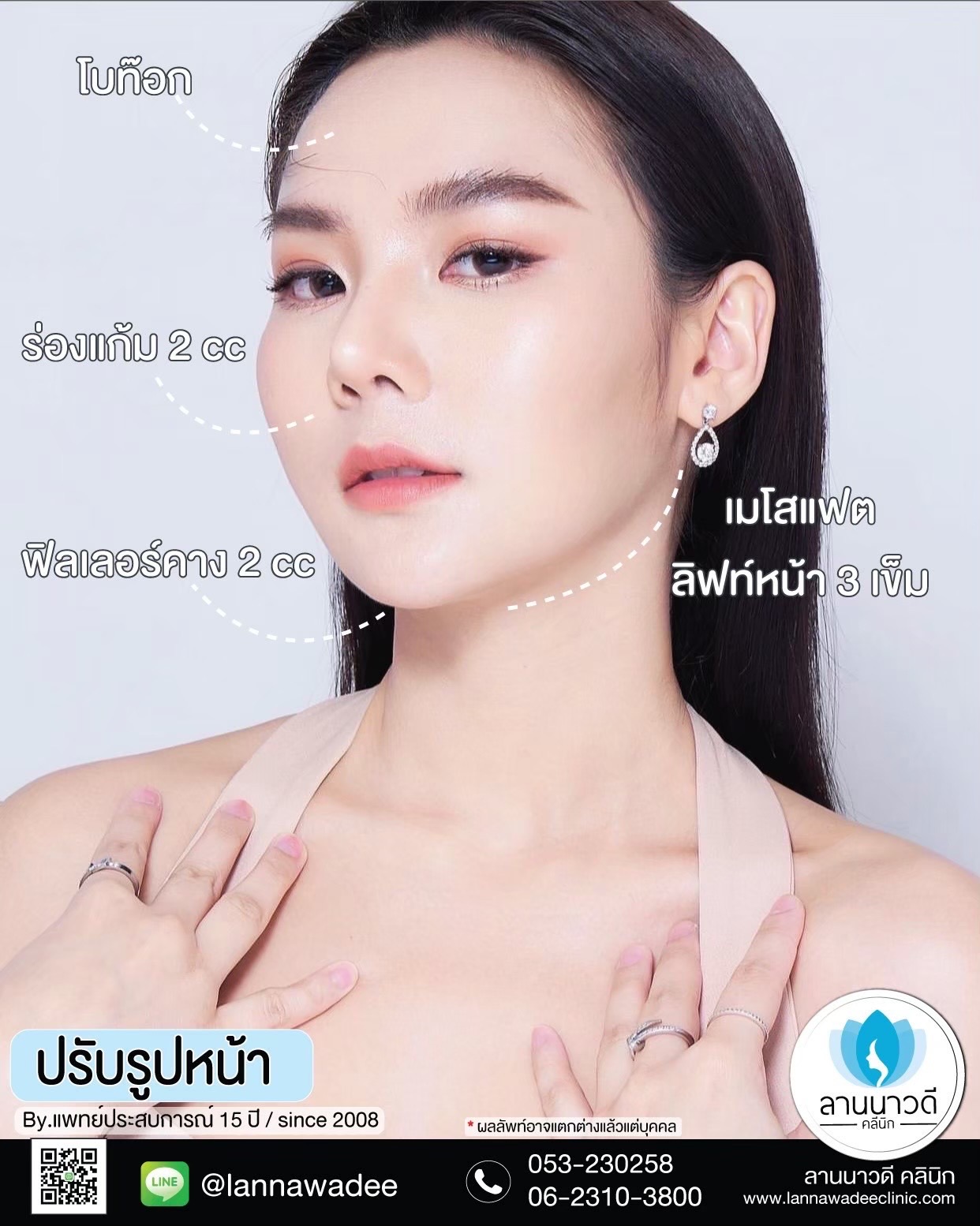 รีวิวฉีดฟิลเลอร์2566