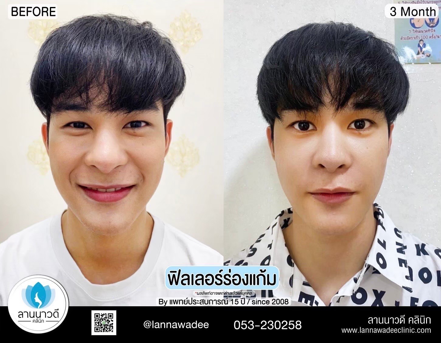 ปรับรูปหน้าที่ไหนดี 2566