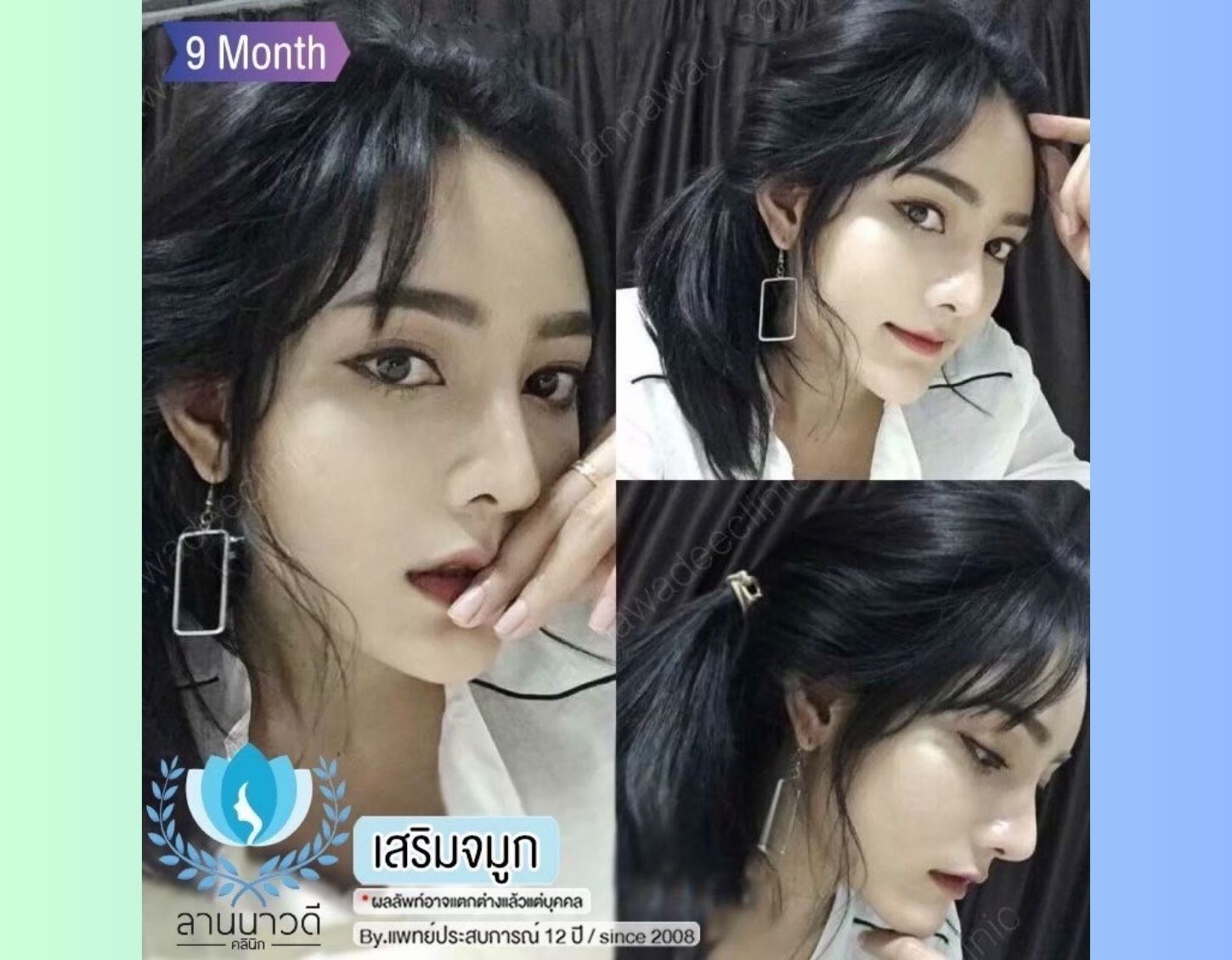 ดีไซน์ที่ยังไม่ได้ตั้งชื่อ (1)