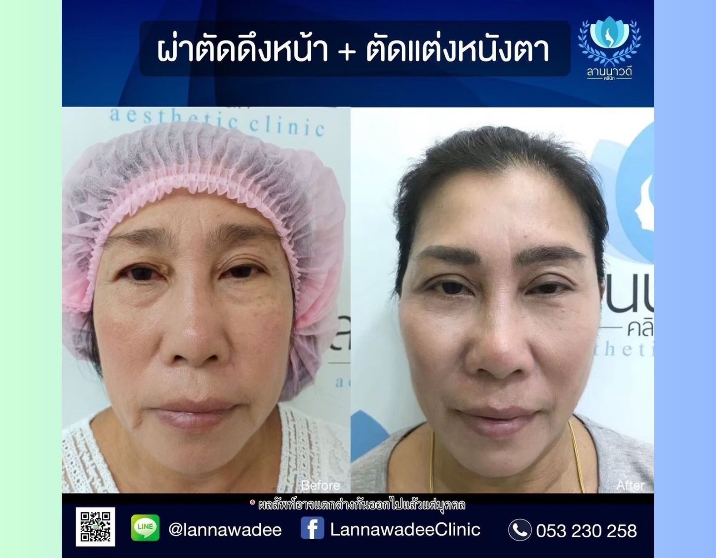 ดีไซน์ที่ยังไม่ได้ตั้งชื่อ (1)