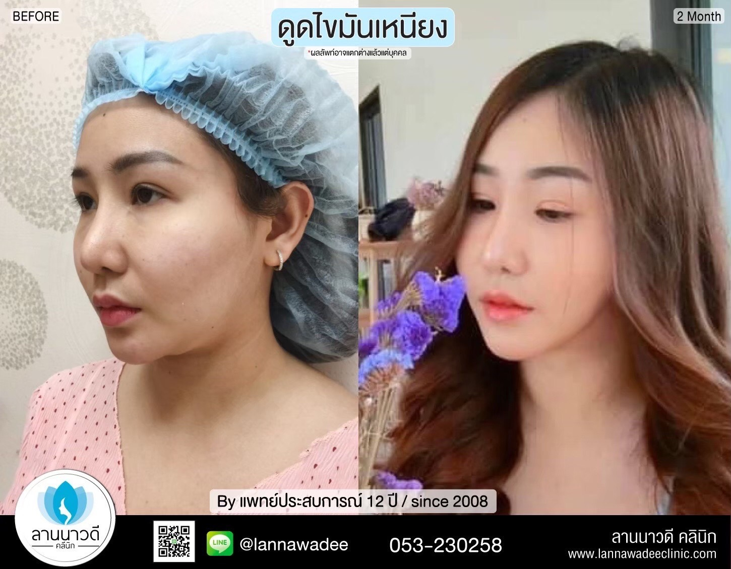 ดีไซน์ที่ยังไม่ได้ตั้งชื่อ (10)