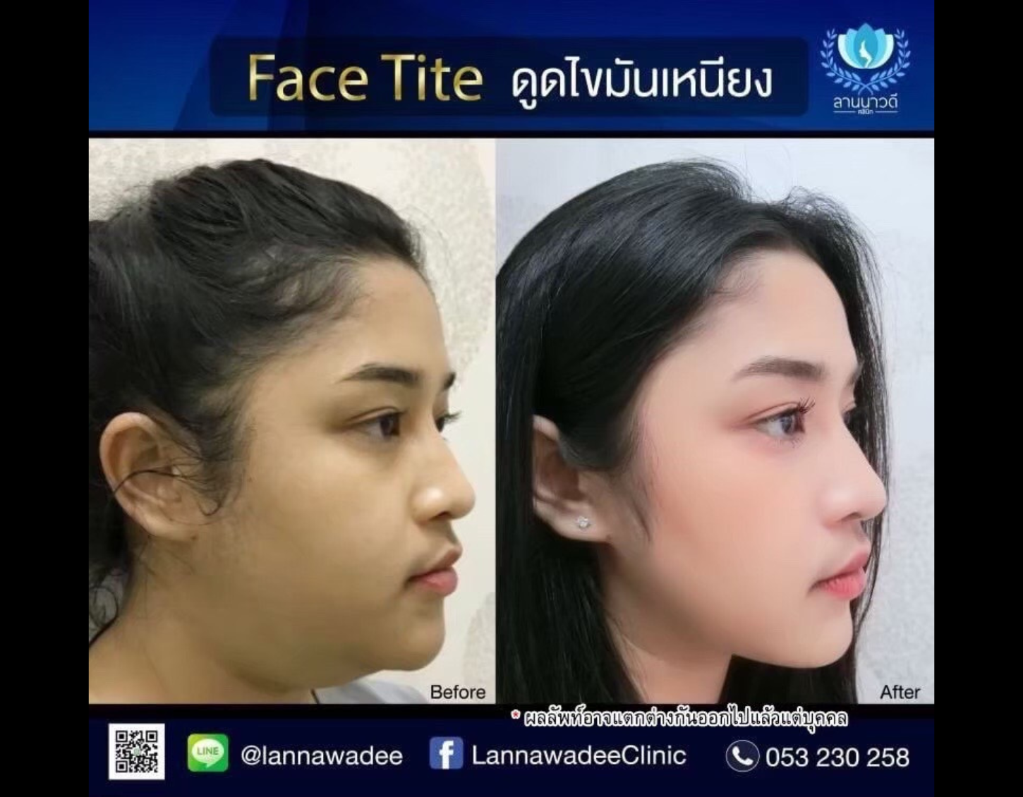 ดีไซน์ที่ยังไม่ได้ตั้งชื่อ (9)