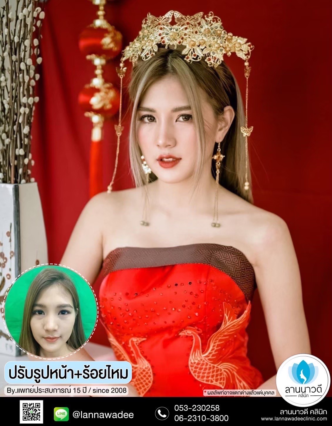 หกฟกหฟ