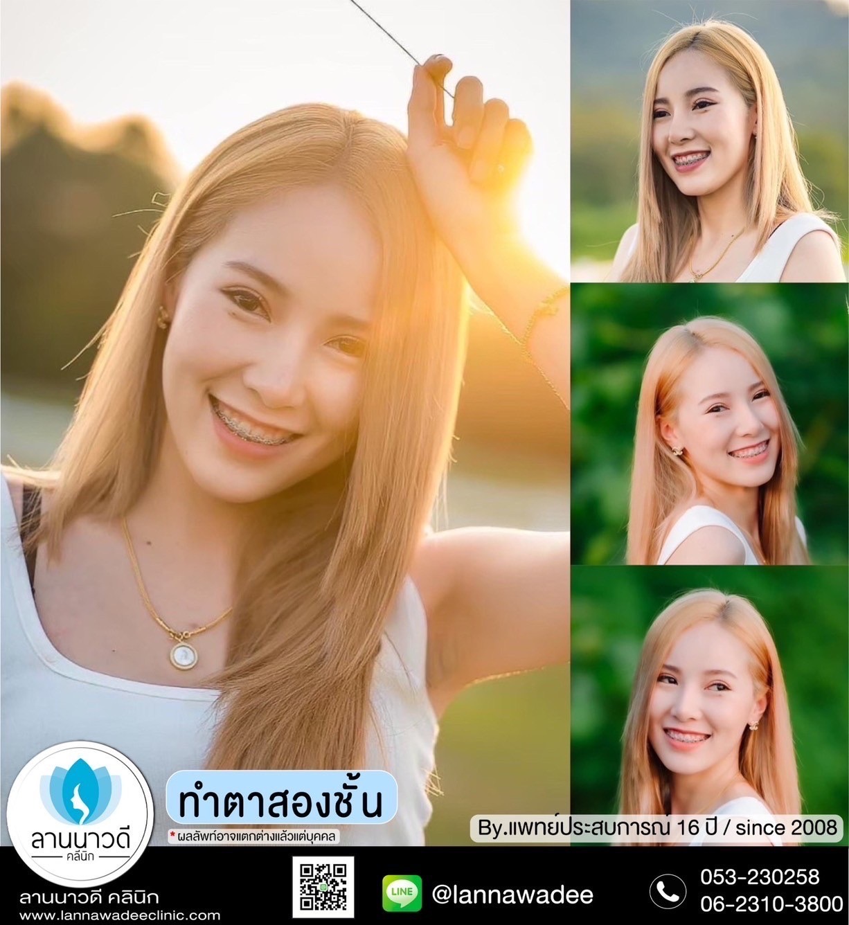 ทำตาสองชั้นที่ไ่หนดี