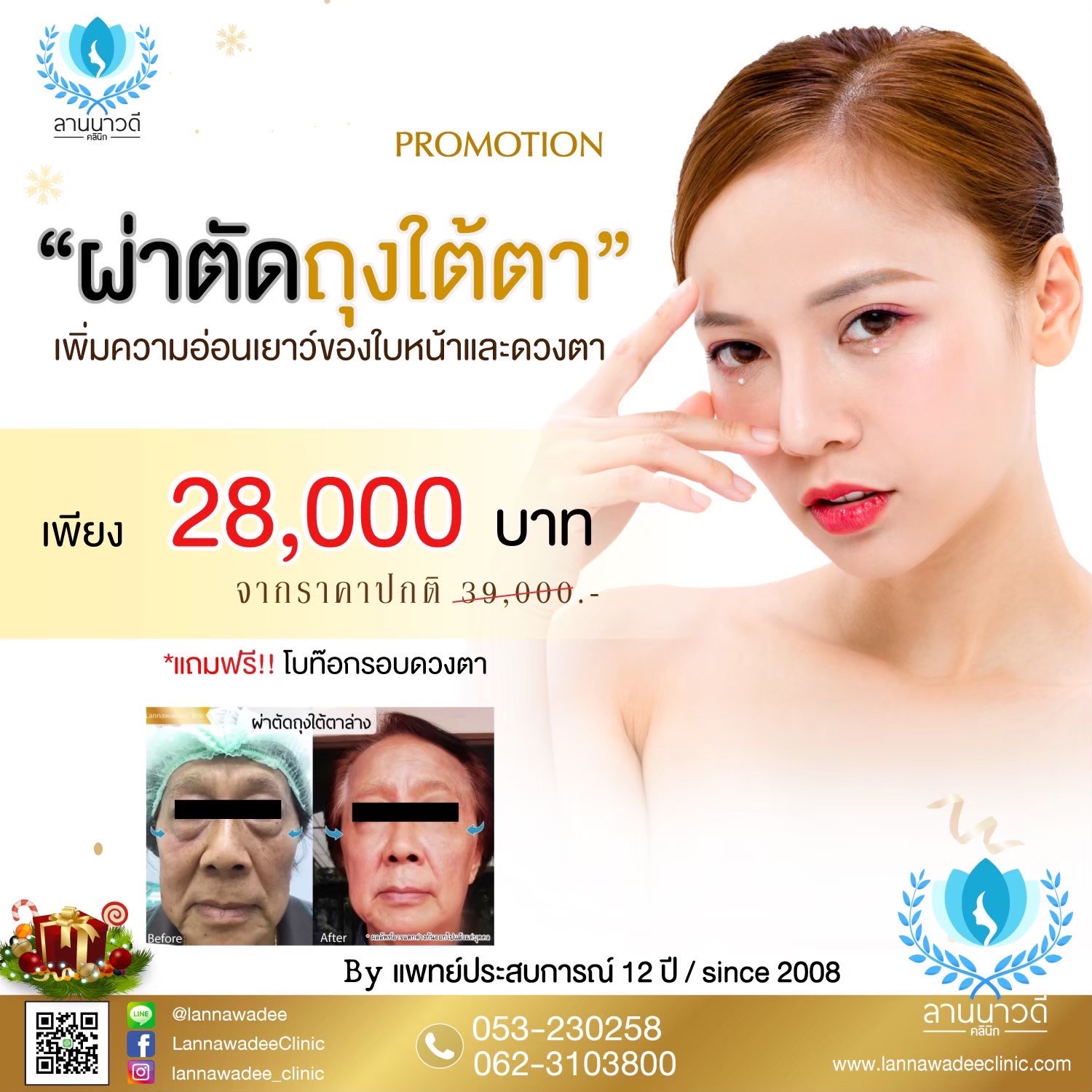 ผ่าตัดถุงใต้ตา ราคา