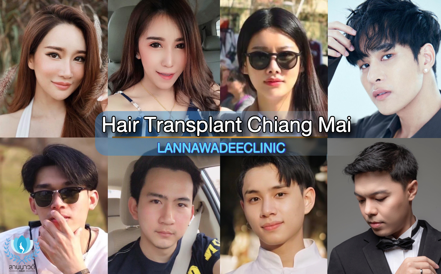 hair transplant chiang mai