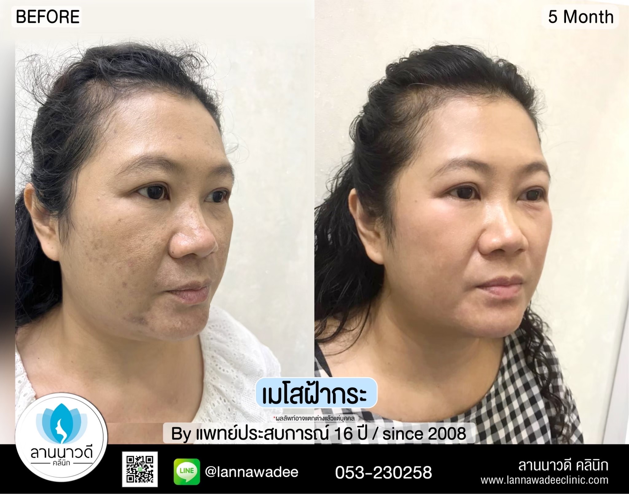 รักษาผ้ากระเชียงใหม่