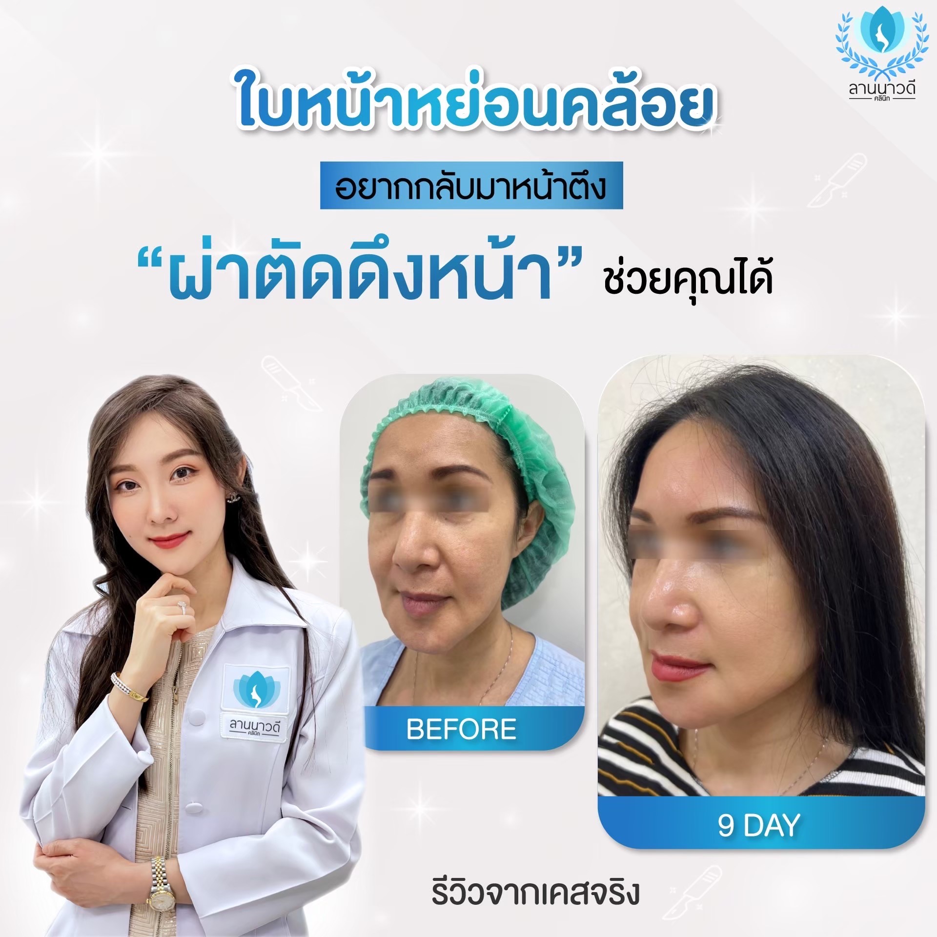 face-lift-chiangmai/