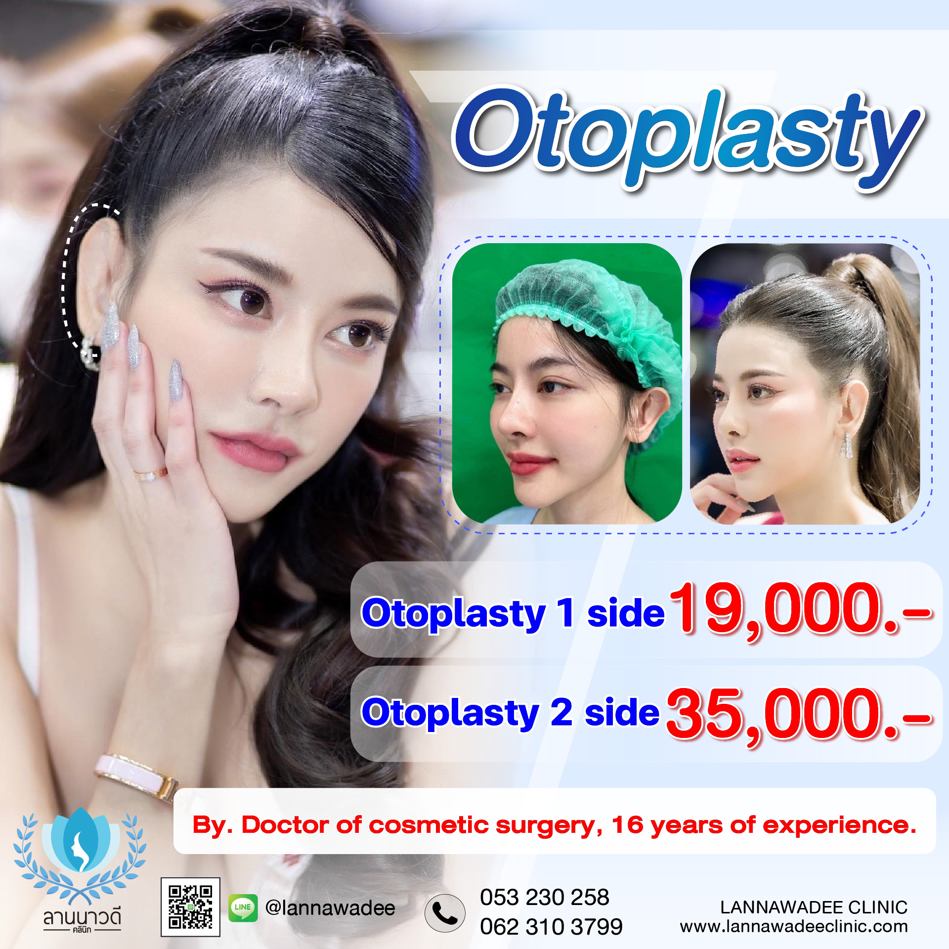 Otoplasty ChiangMai