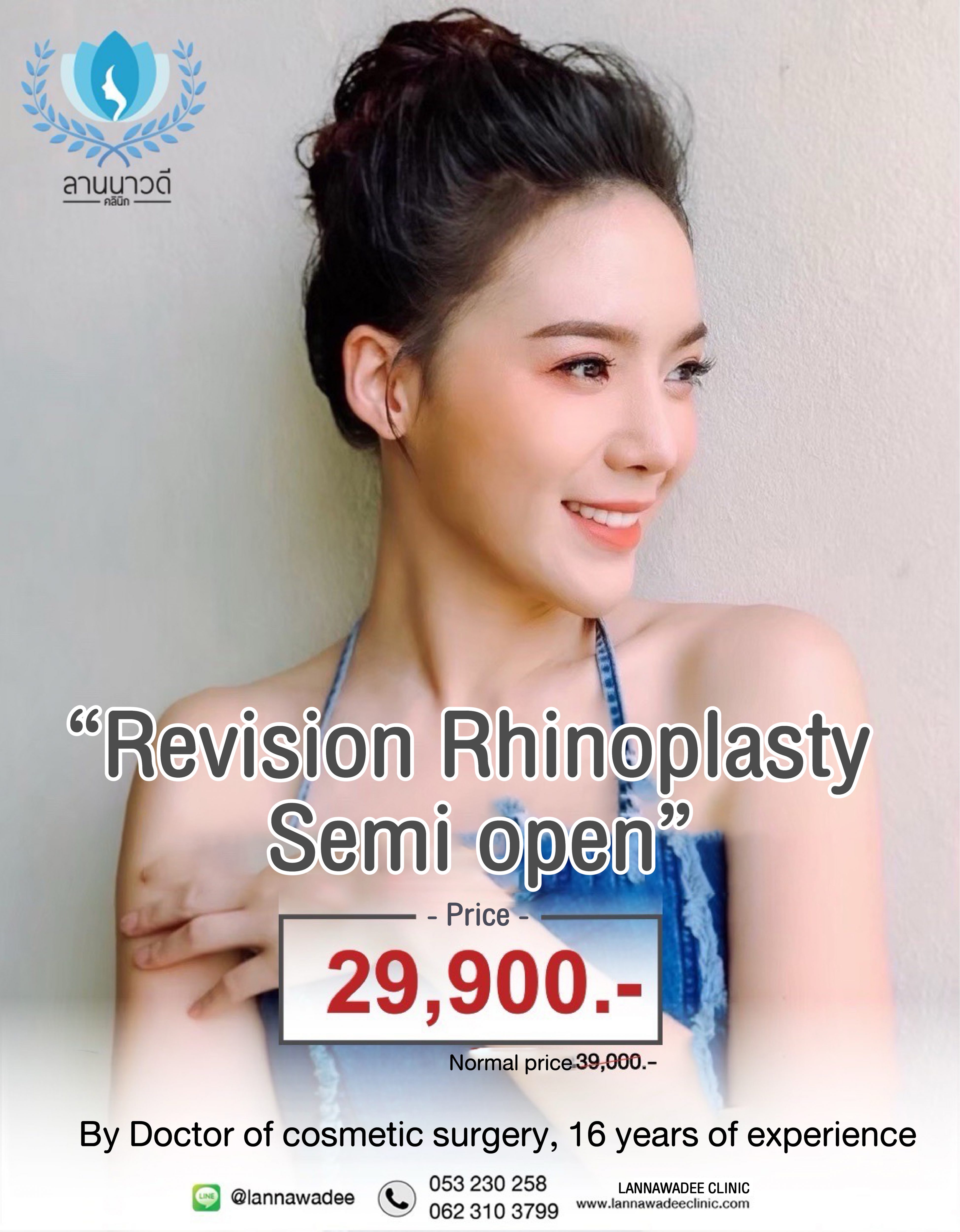 Revision Rhinoplasty