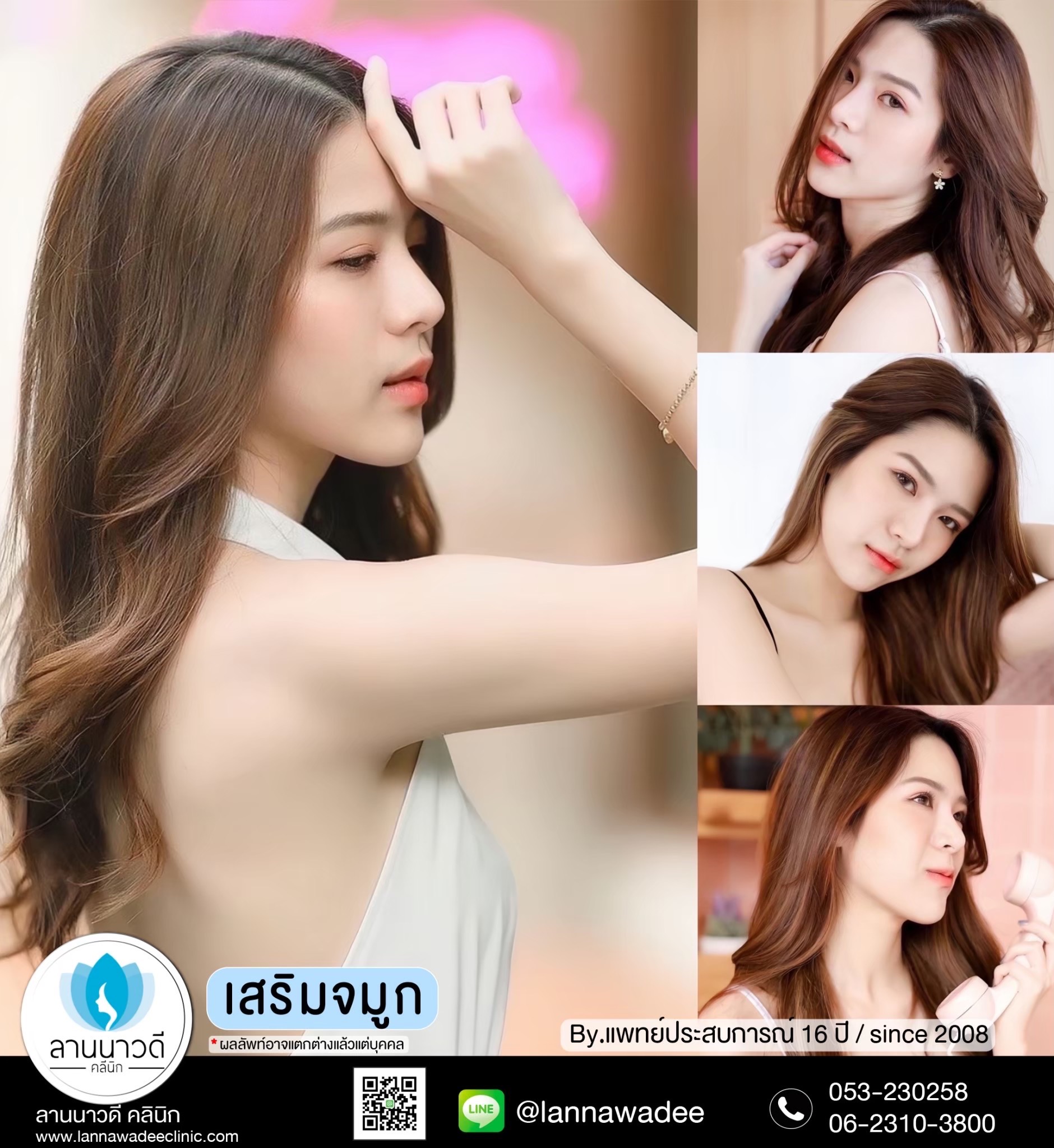 รีวิวเสริมจมูกเชียงใหม่