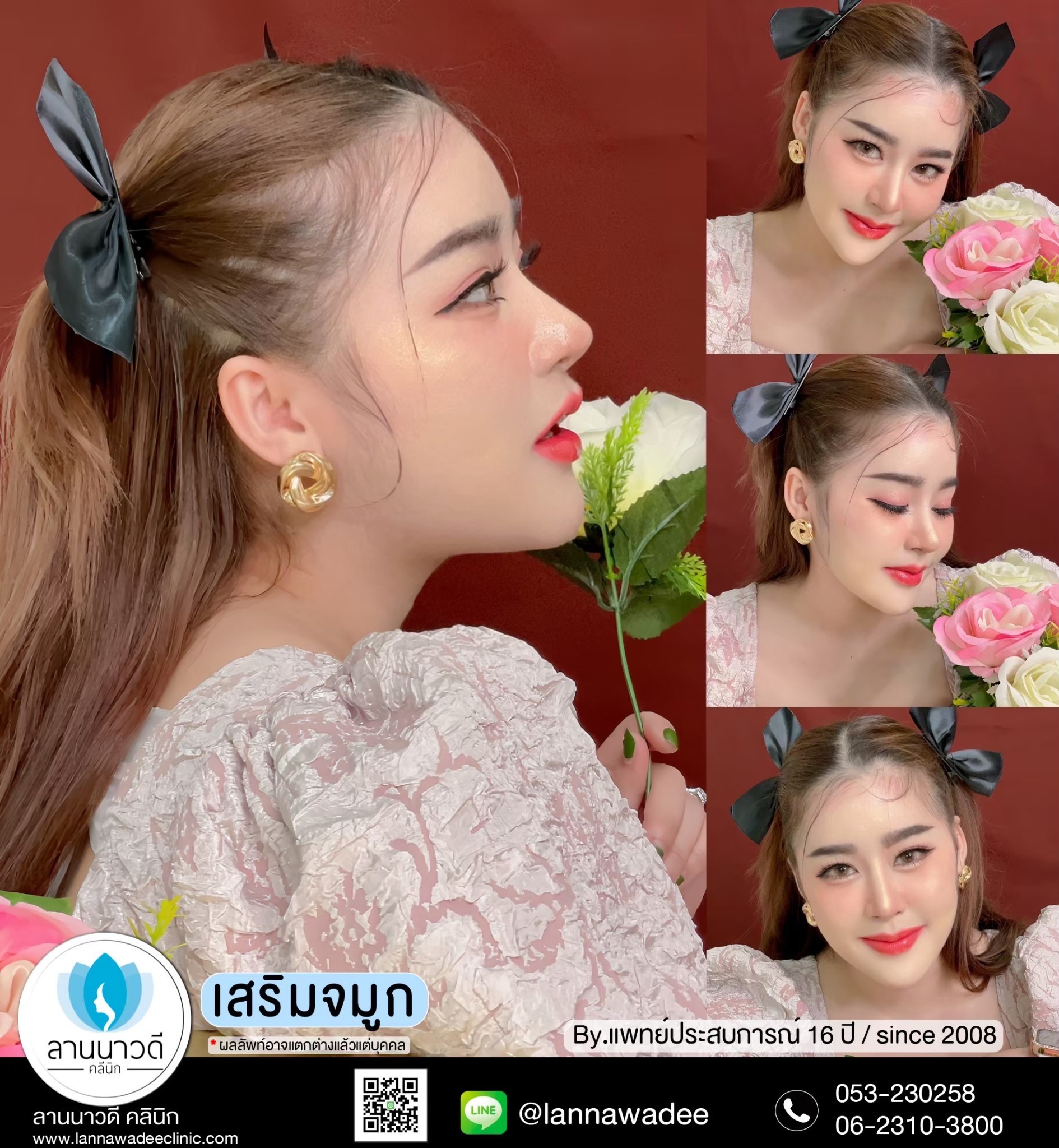 รีวิวเสริมจมูกเชียงใหม่