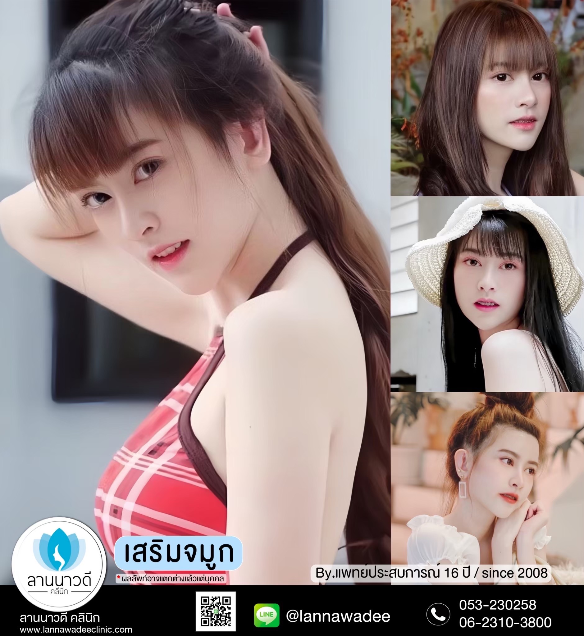 ตัดปีกจมูกเชียงใหม่