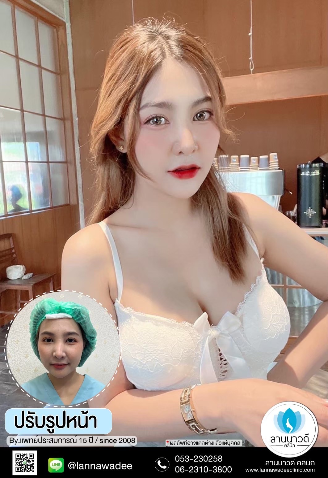 รักษาฝ้ากระเชียงใหม่