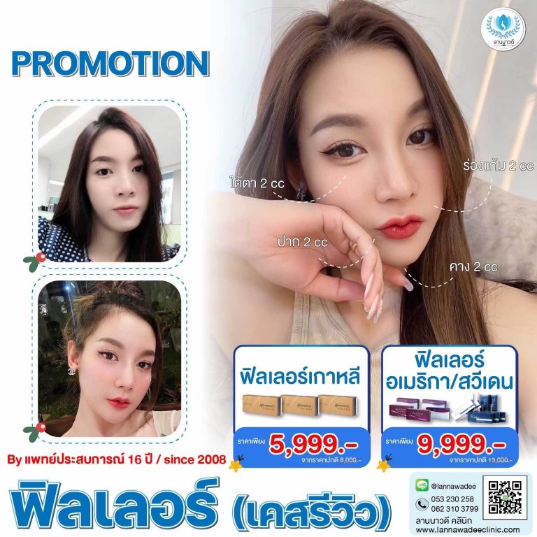 ฟิลเลอร์ปากเชียงใหม่