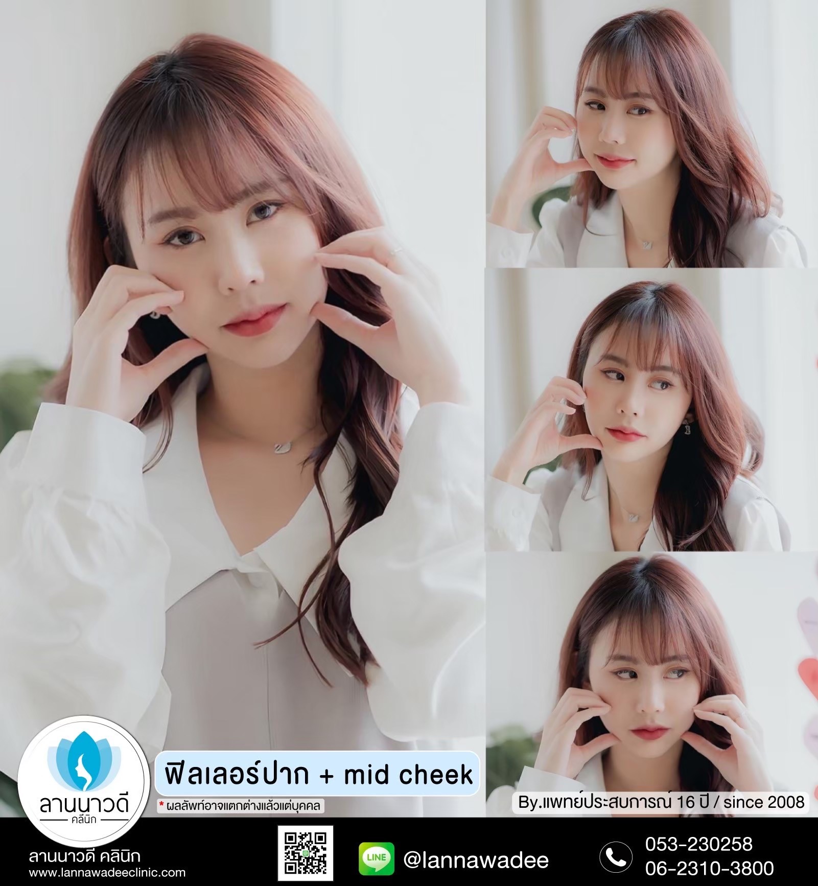 ฟิลเลอร์ปากเชียงใหม่