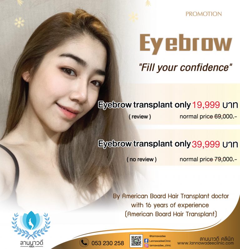 Eyebrow Transplant