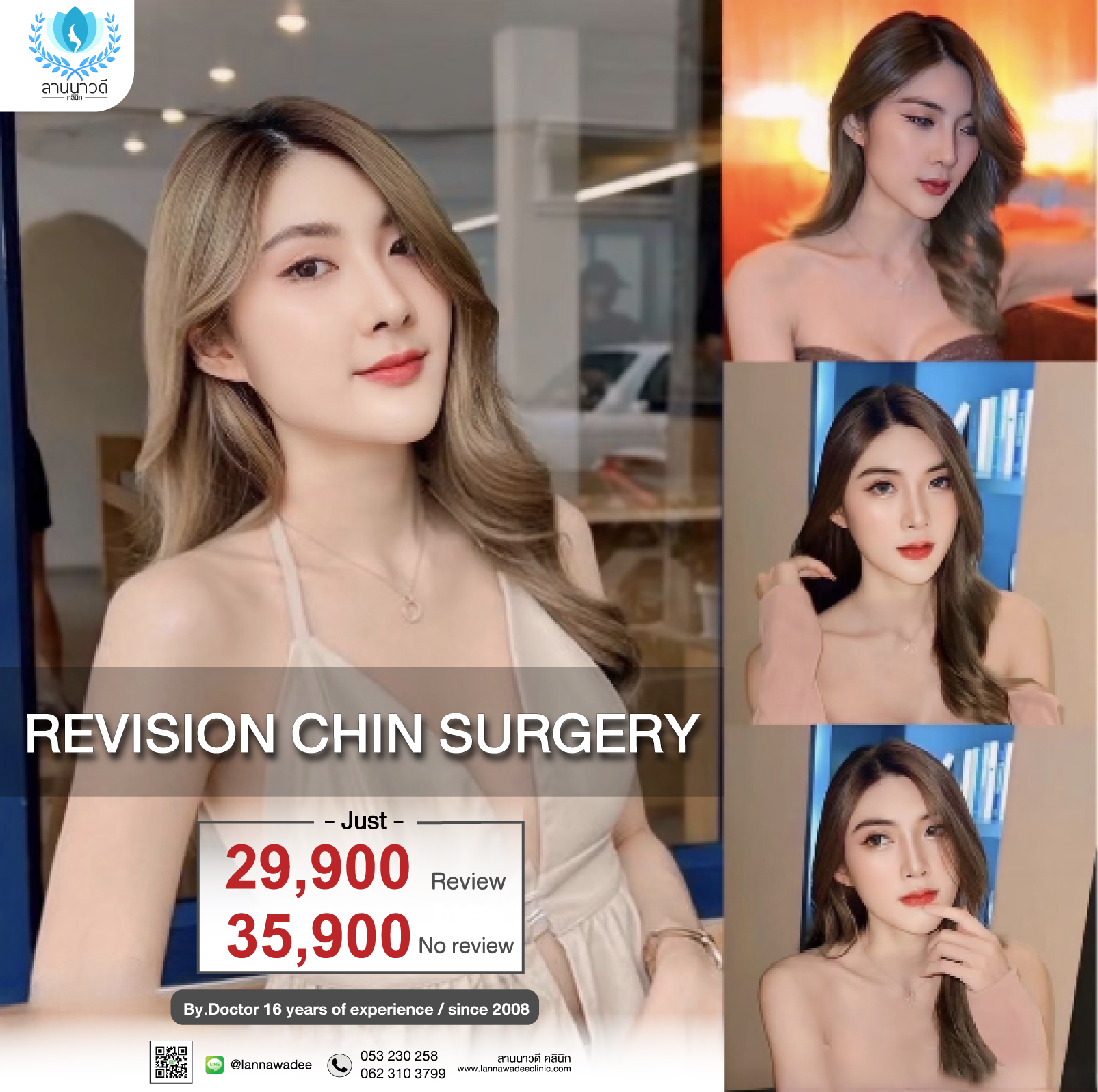 Revision Chin surgery
