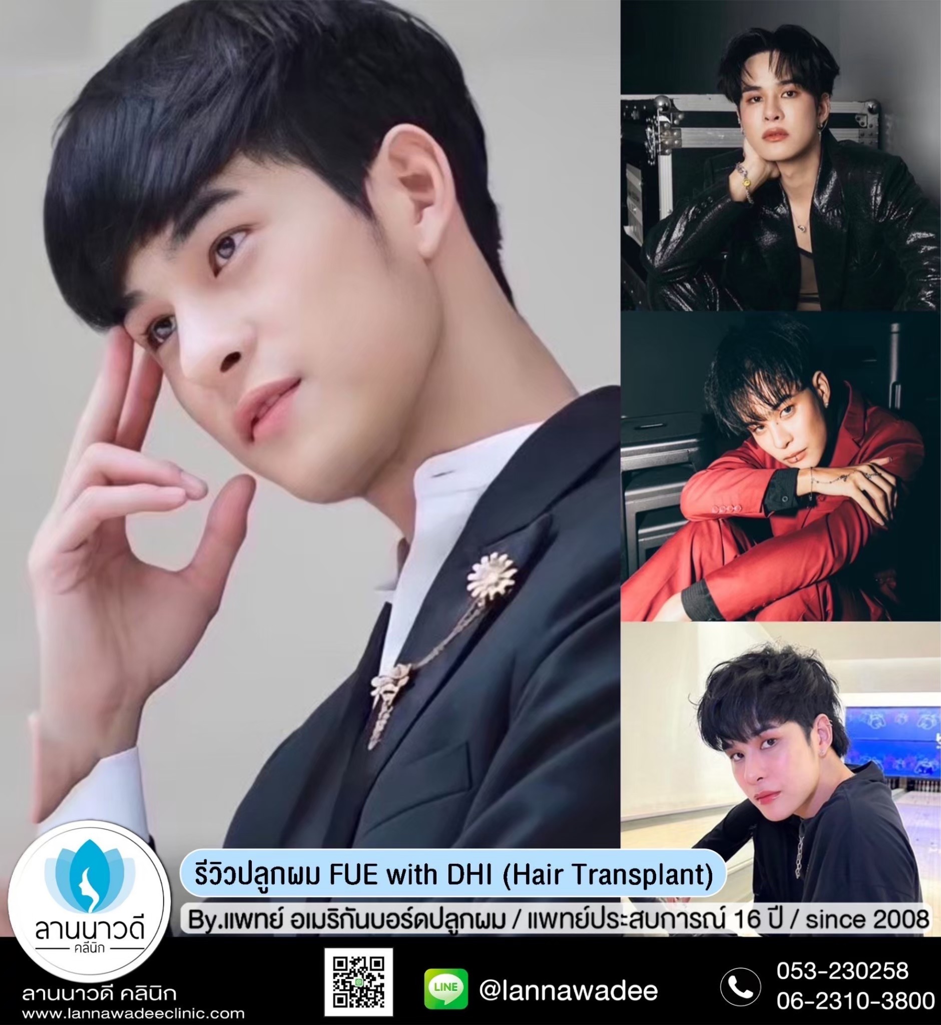 ปลูกผม