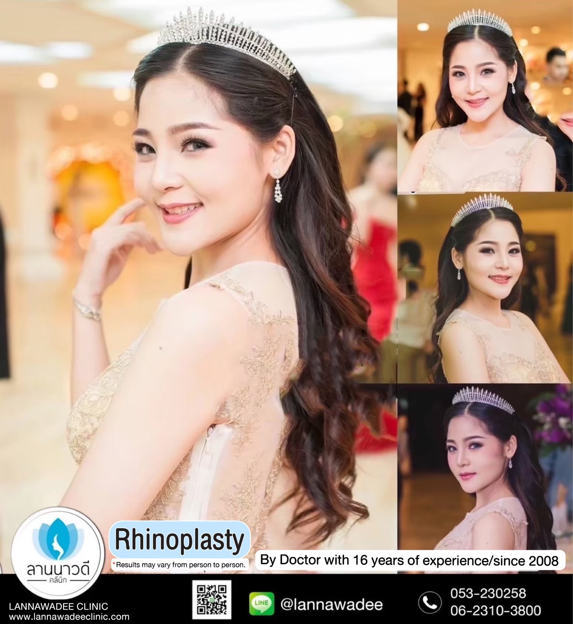 เสริมจมูก-เชียงใหม่
