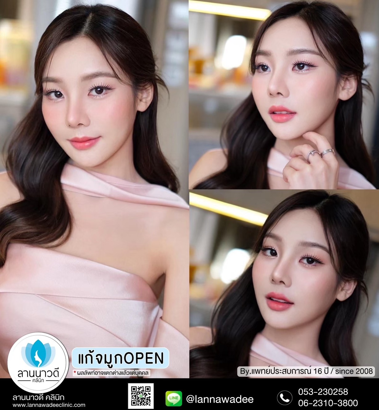 เสริมจมูก-เชียงใหม่