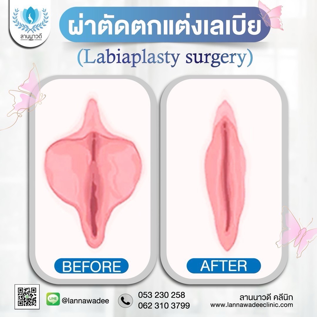 รีแพร์เชียงใหม่