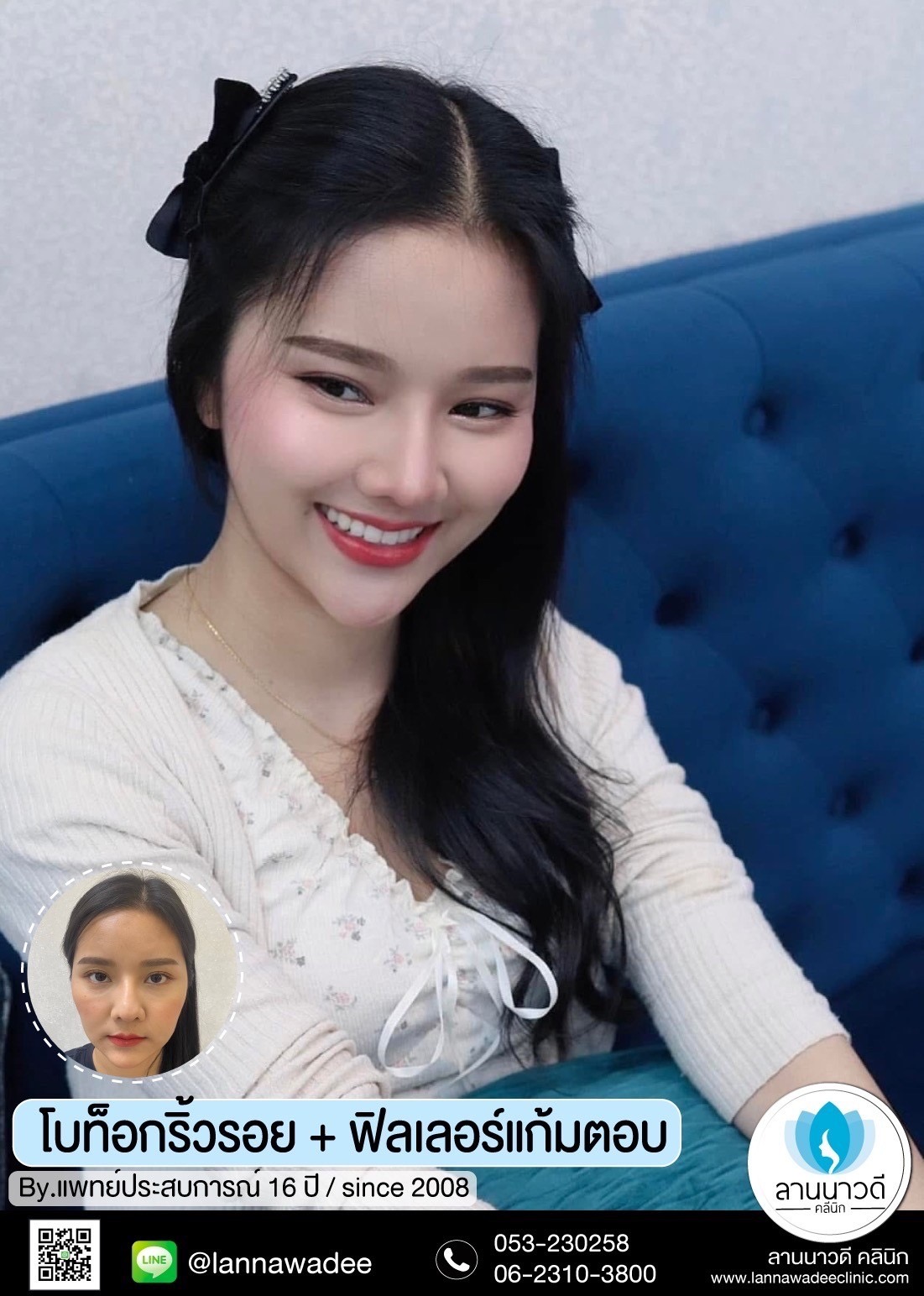 ฉัดโบท๊อก