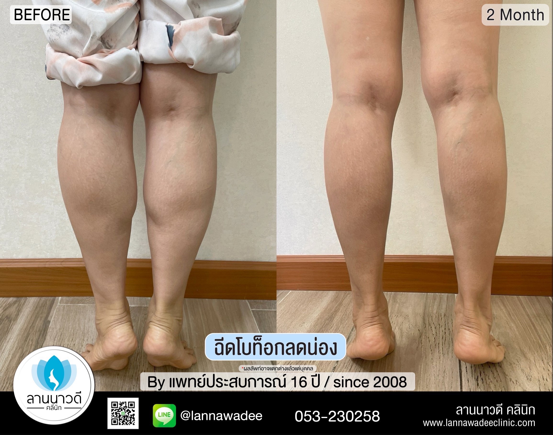 โบท๊อกน่อง