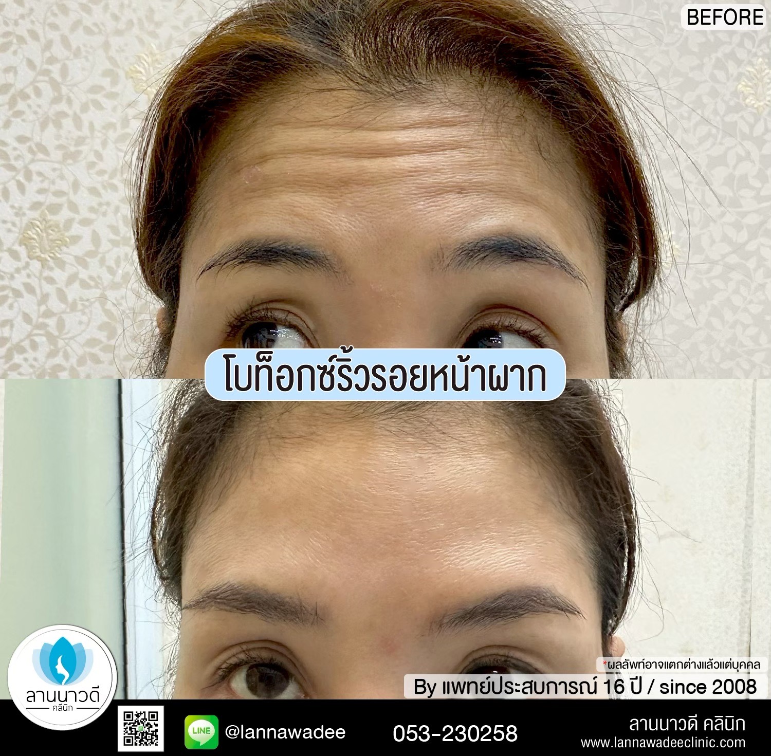 ลดน่องเชียงใหม่