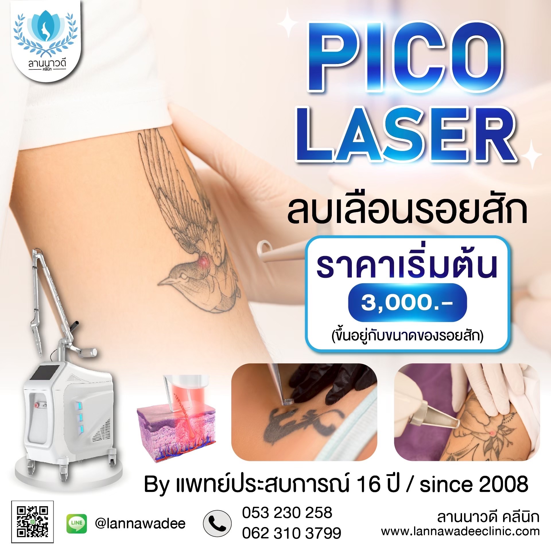 ลบรอยสักที่ไหนดี