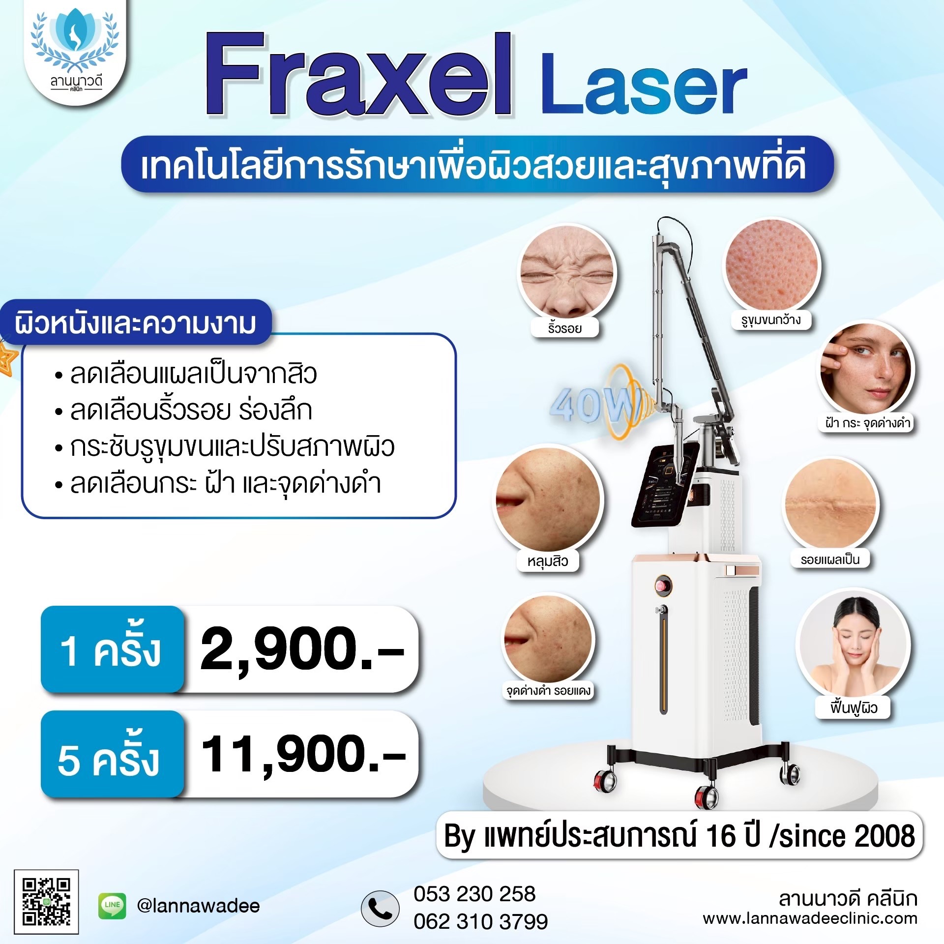 เลเซอร์หลุมสิวที่ไหนดี