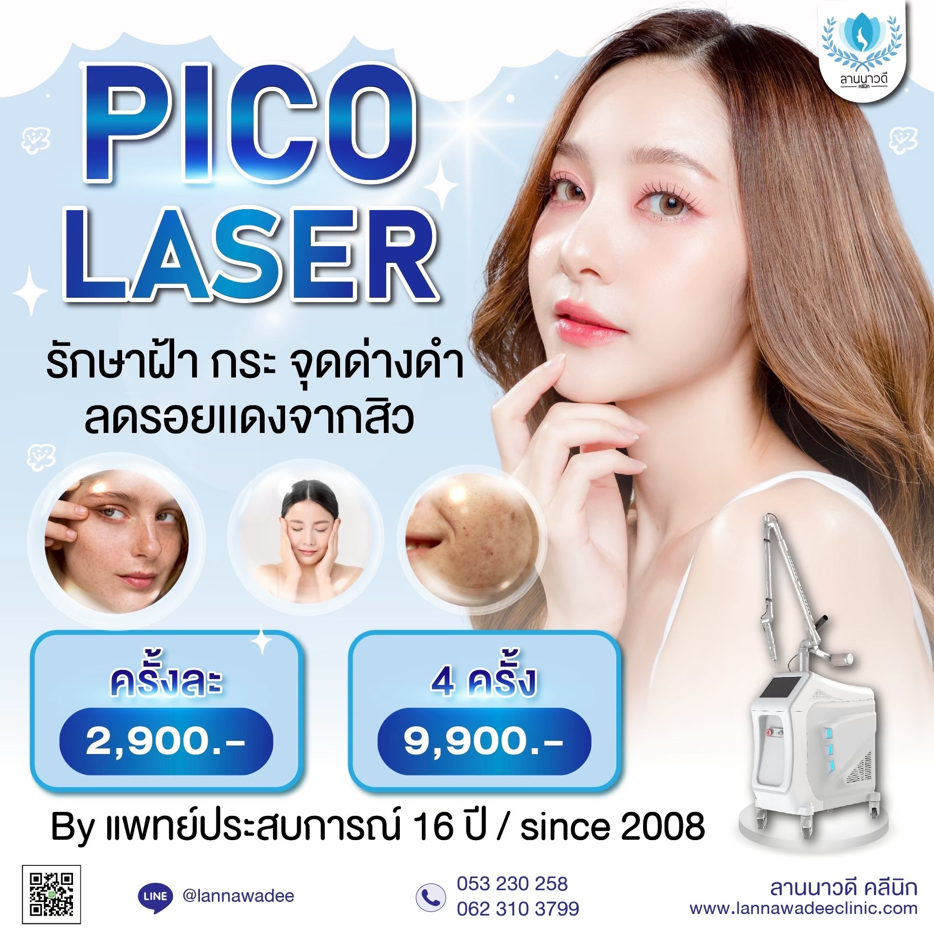 เลเซอร์หลุมสิว