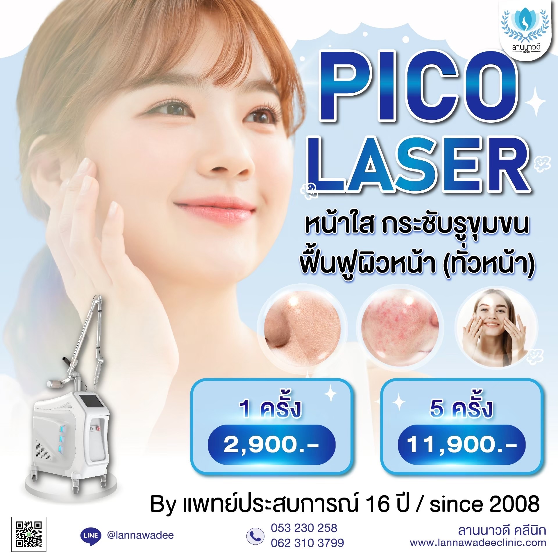 Pico Laser ที่ไหนดี