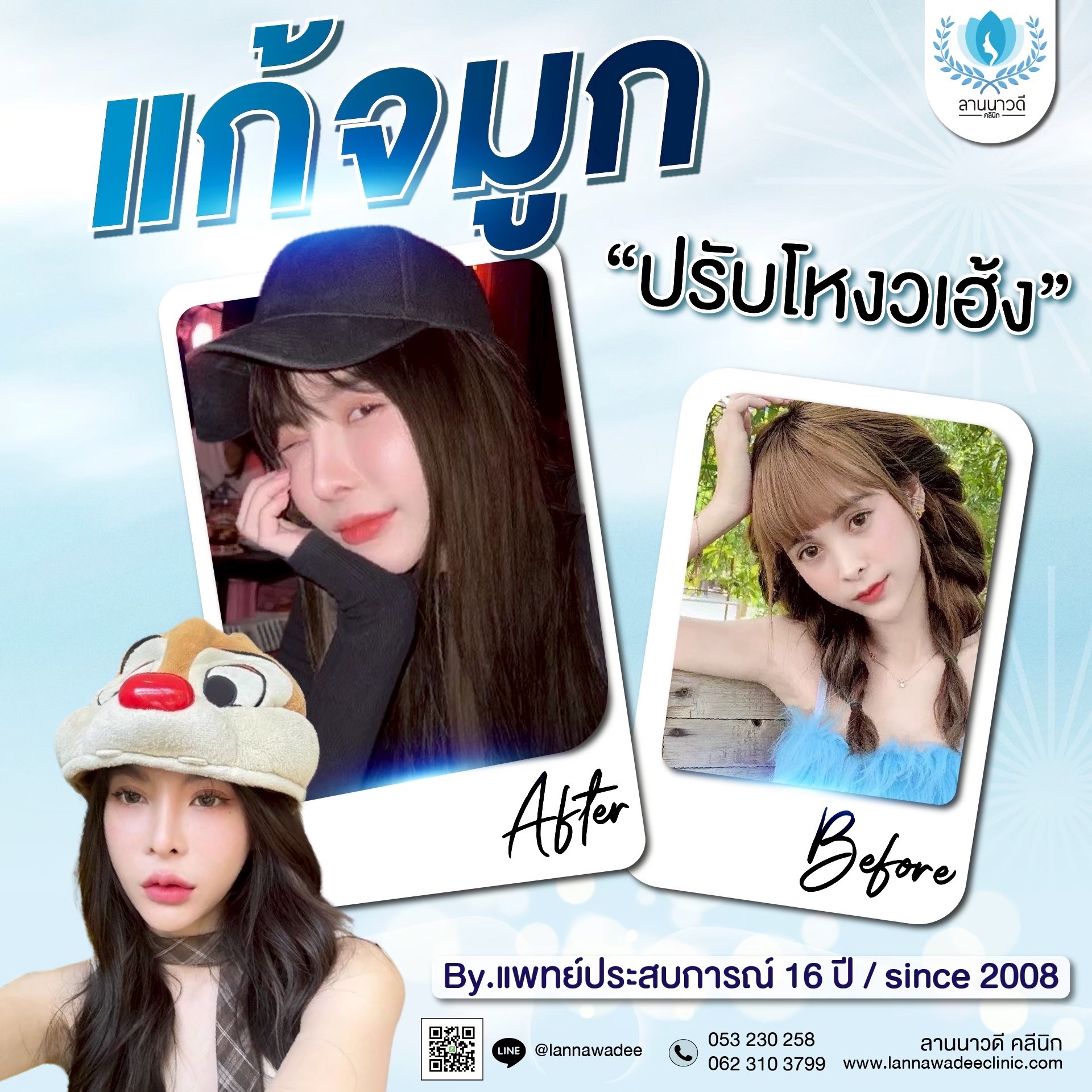 แก้จมูก