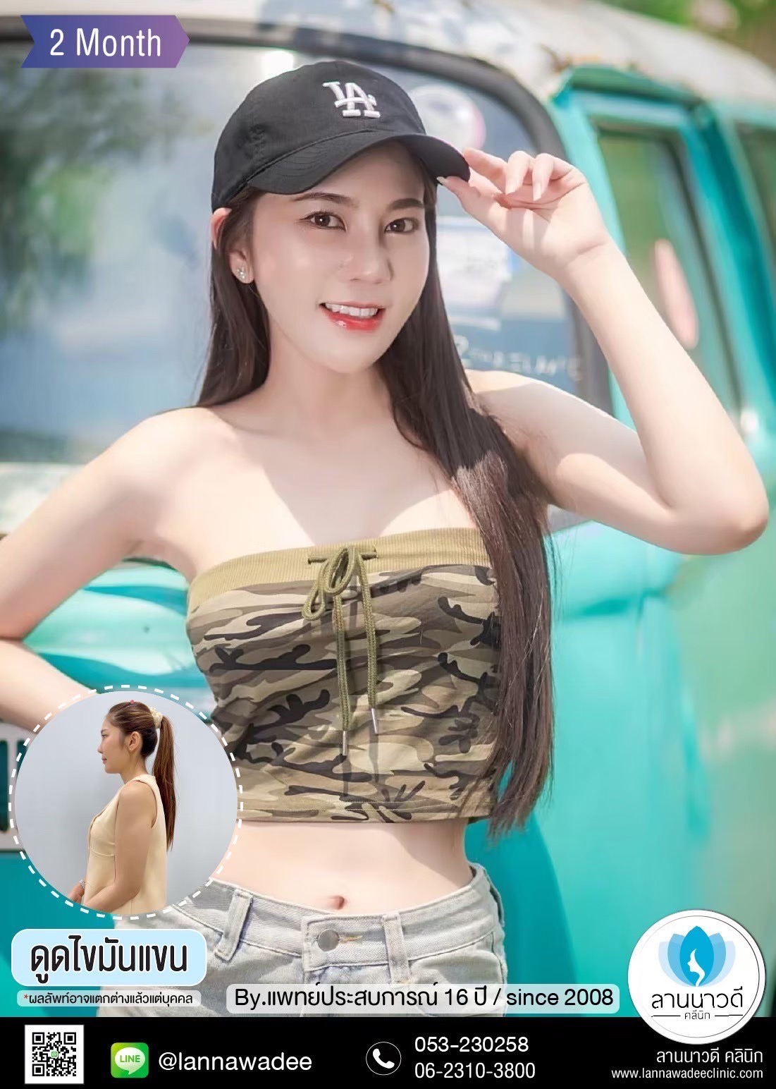 lanna