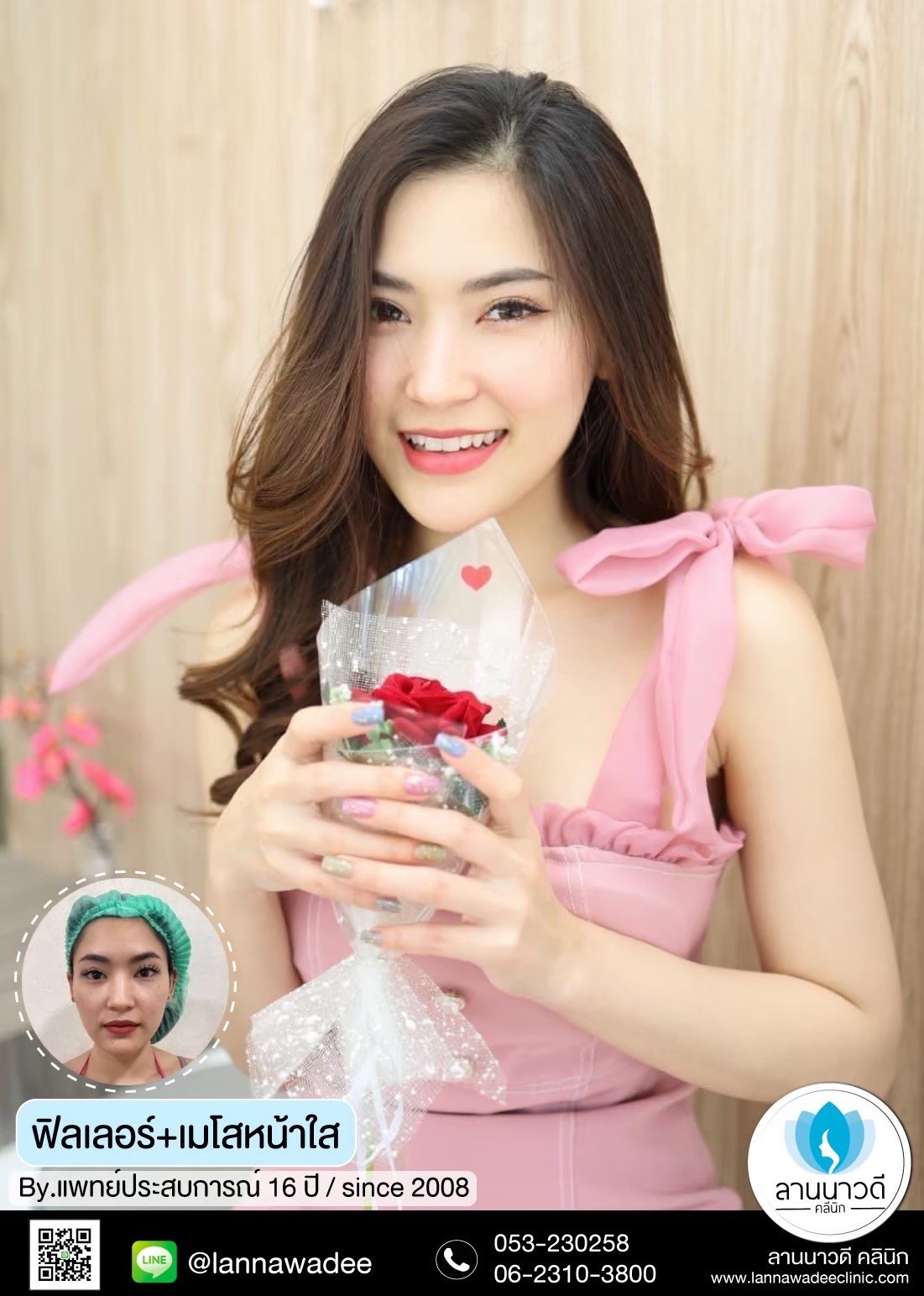 Filler chiangmai lanna