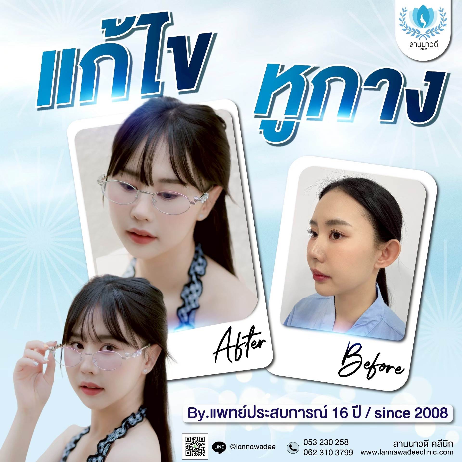 แก้หูกาง