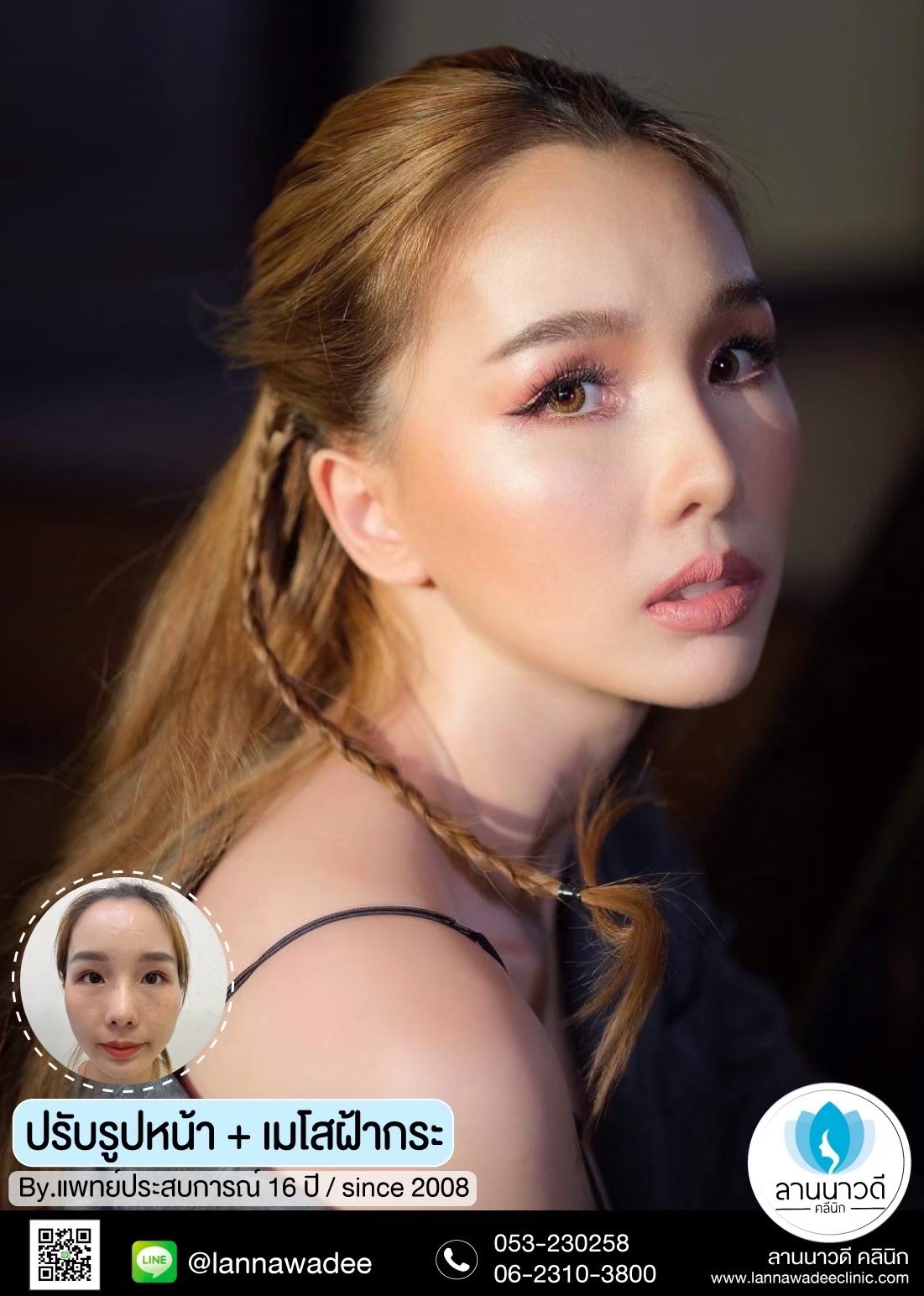 คลินิกรักษาฝ้ากระ