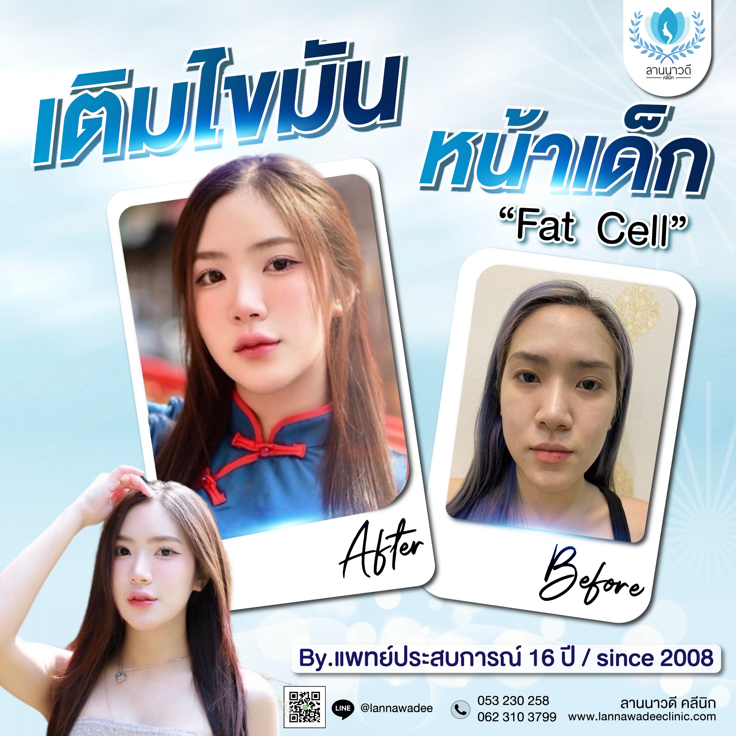 เติมไขมัน