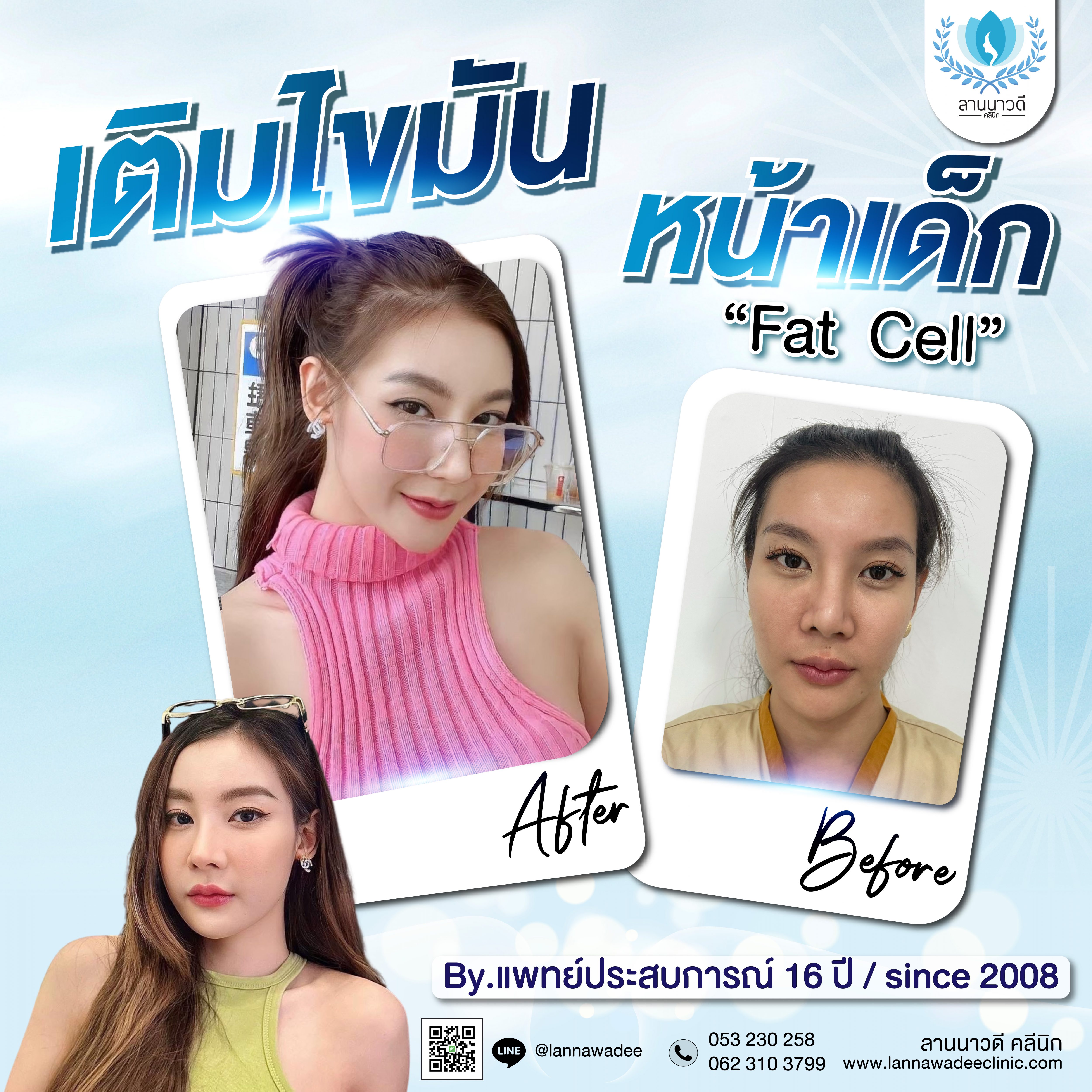 เติมไขมัน