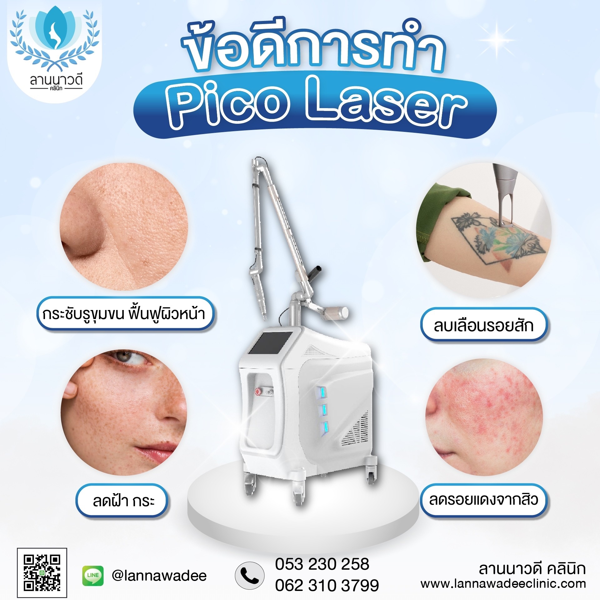 เลเซอร์ฝ้ากระที่ไหนดี เลเซอร์ฝ้ากระที่ไหนดี