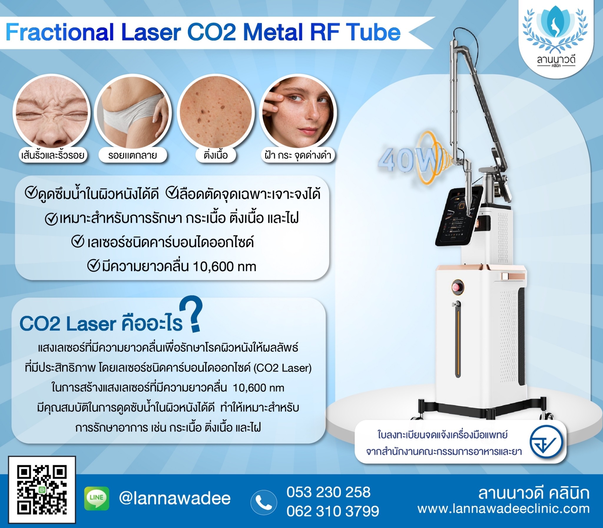 เลเซอร์ฝ้ากระที่ไหนดี