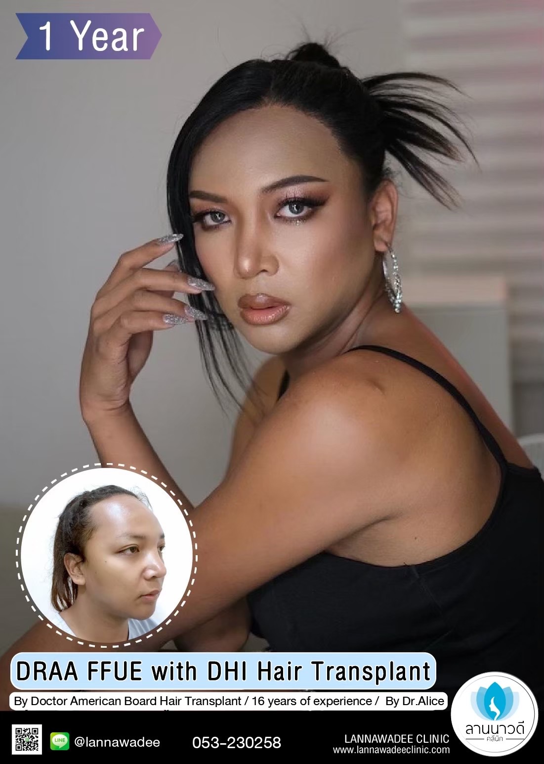 ABHRS hair transplant Thailand