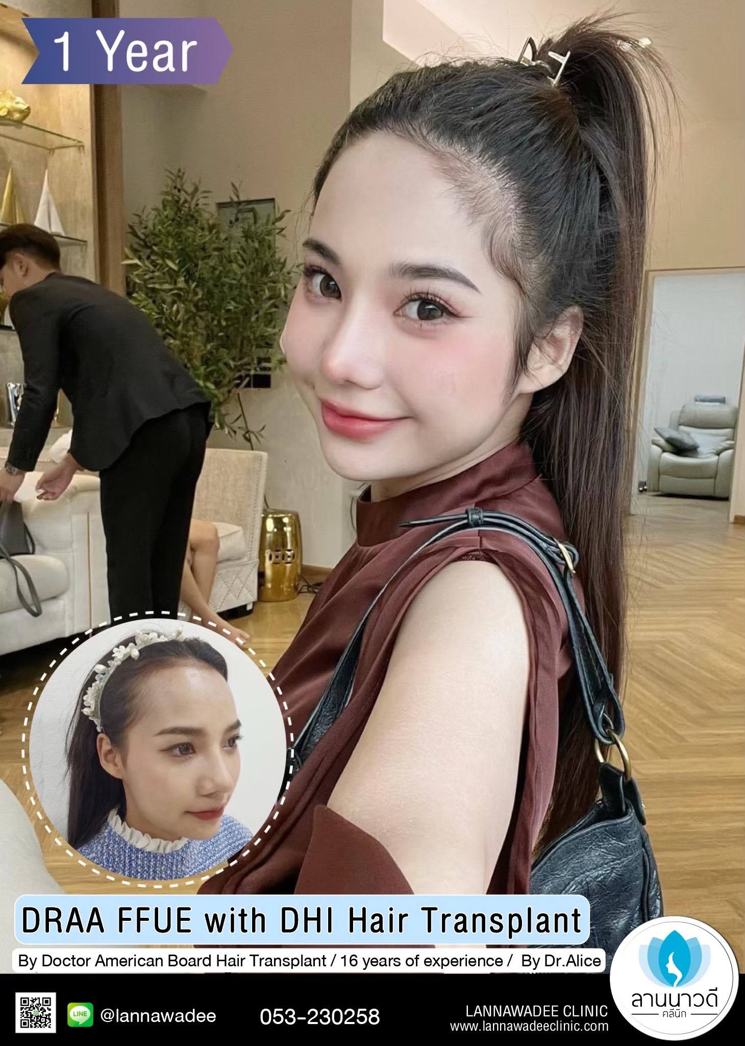 ABHRS hair transplant Thailand