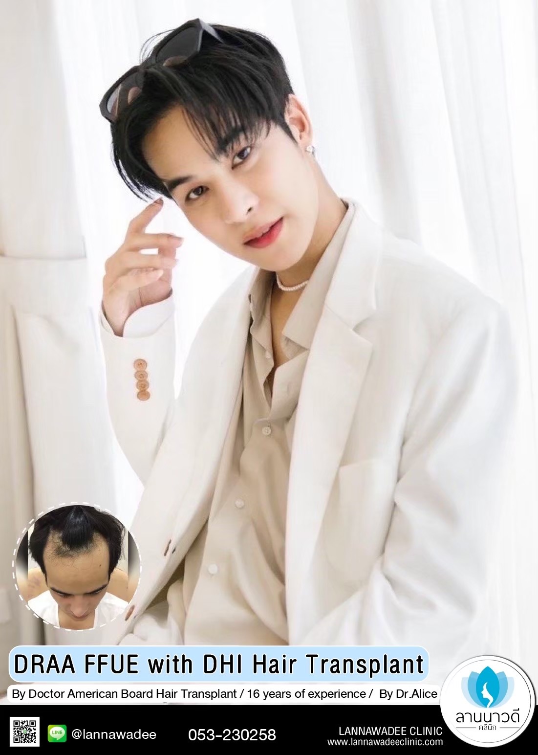 ABHRS hair transplant Thailand