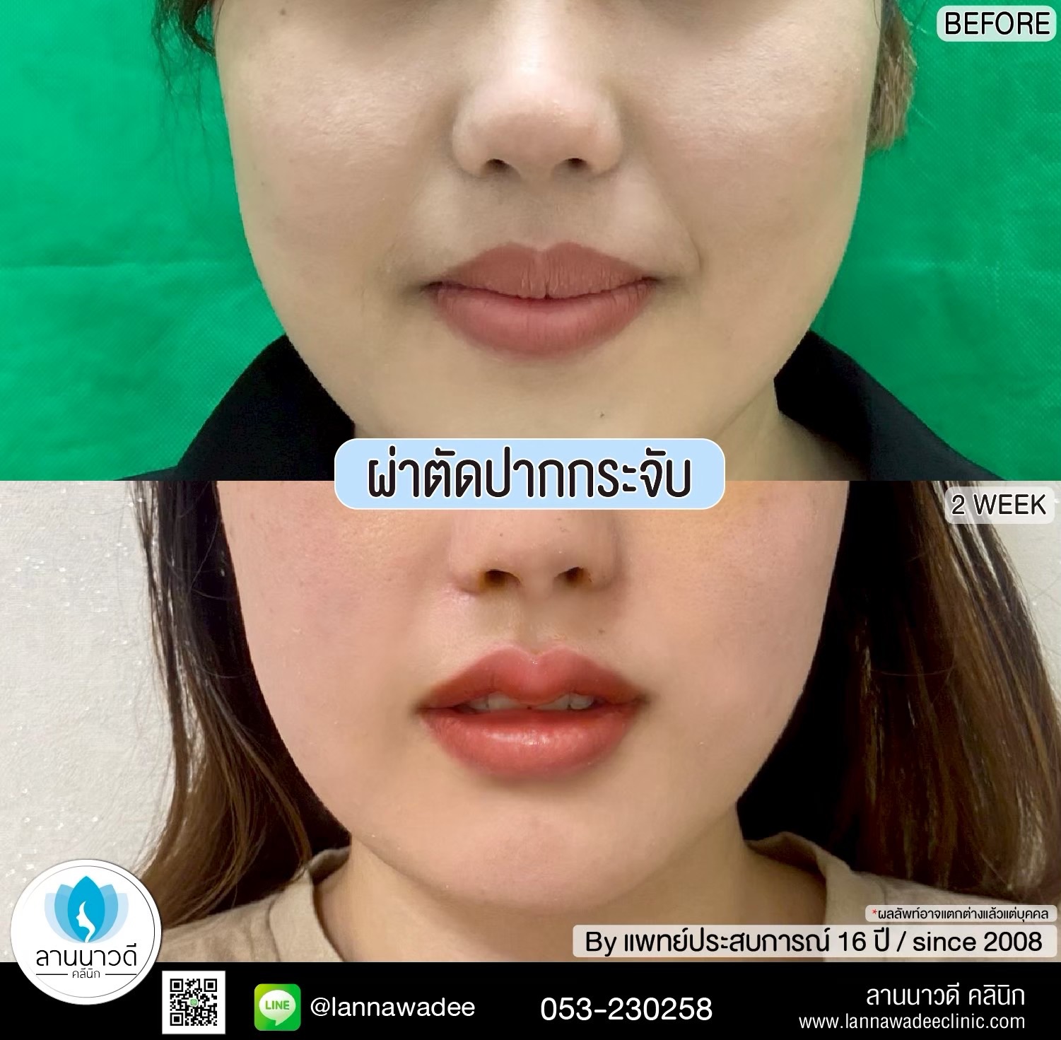 คลินิกศัลยกรรมความงาม