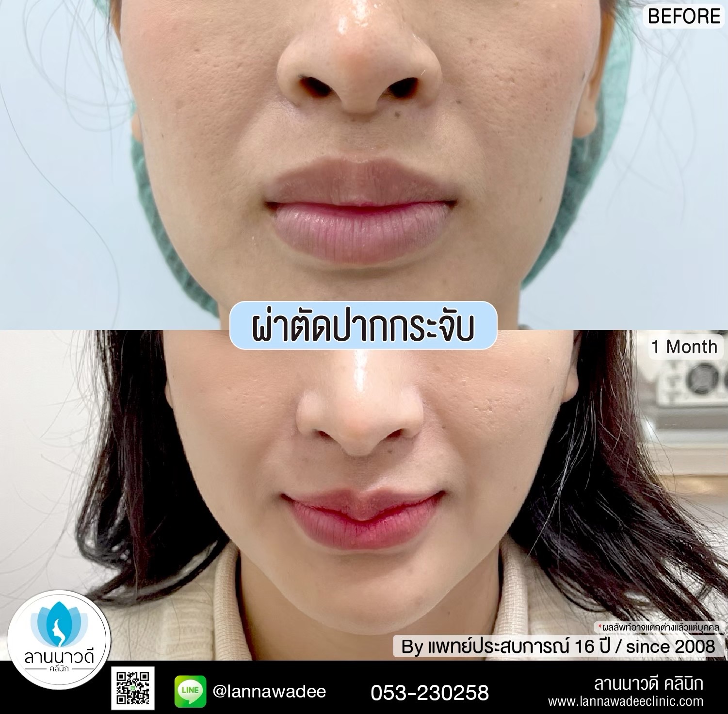 คลินิกศัลยกรรมความงาม