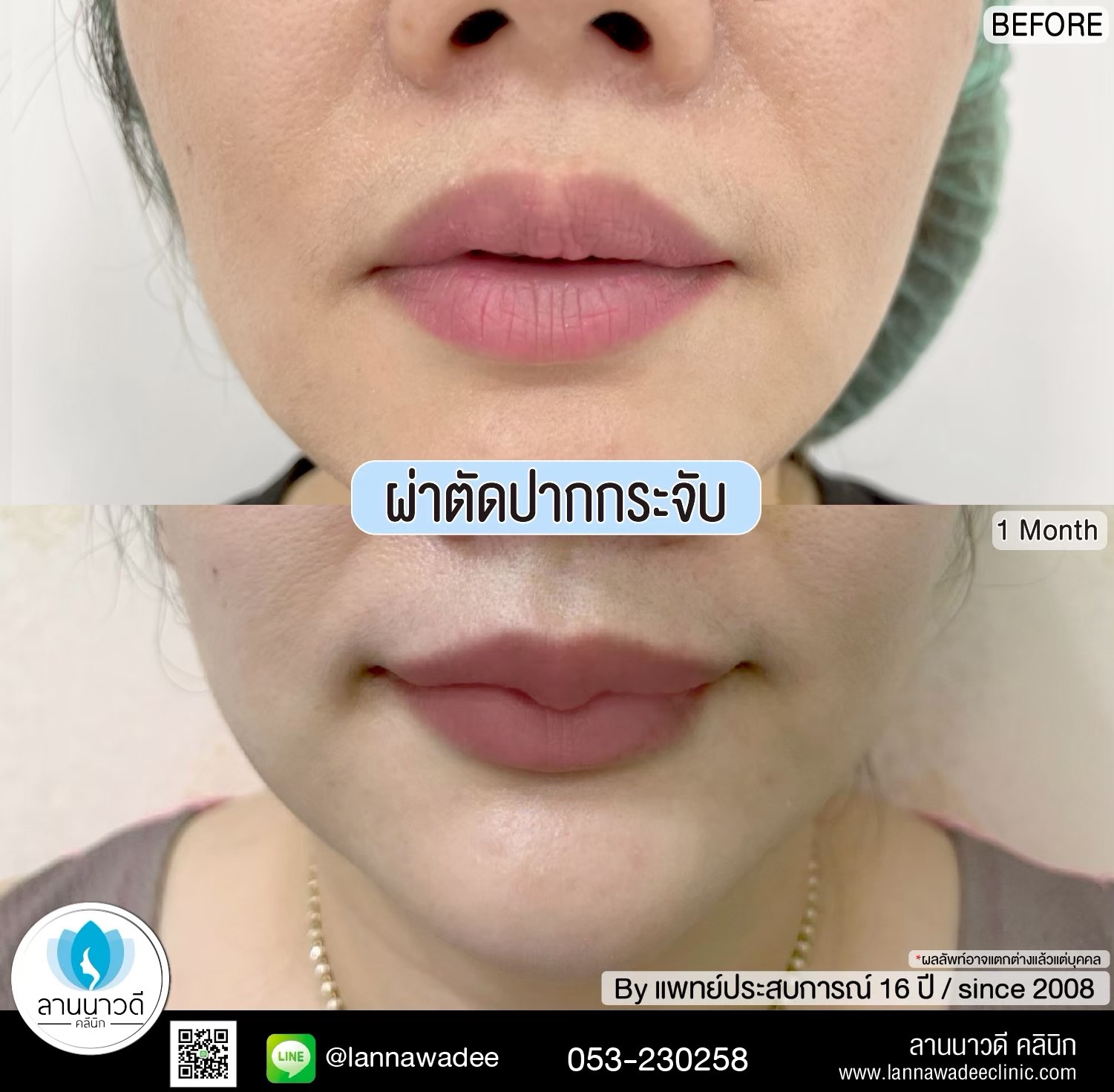 คลินิกศัลยกรรมความงาม