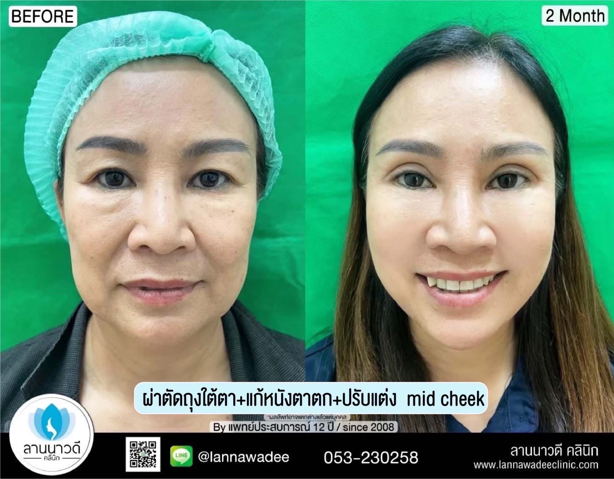 คลินิกศัลยกรรมความงาม